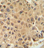 AP52242PU-N - ISCA2 / HBLD1
