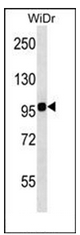 AP52254PU-N - Integrin beta-7