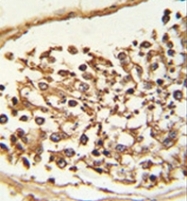 AP52269PU-N - JMJD2B / KDM4B