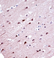 AP52303PU-N - KCND2
