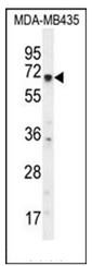 AP52316PU-N - KCNQ1