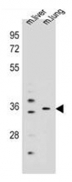 AP52319PU-N - KCNRG