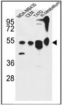 AP52338PU-N - ATG13