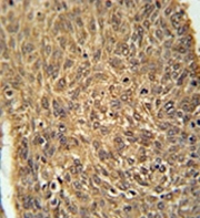 AP52338PU-N - ATG13