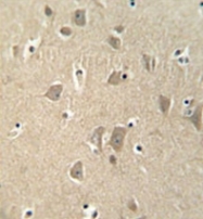 AP52356PU-N - MGC48628
