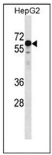 AP52387PU-N - Kelch-like protein 25