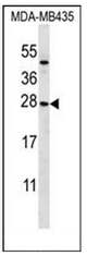AP52396PU-N - KLRC1 / CD159a