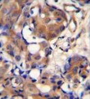 AP52400PU-N - Kininogen-1