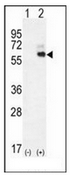 AP52400PU-N - Kininogen-1