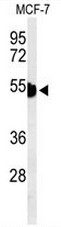 AP52410PU-N - Cytokeratin 1
