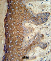 AP52410PU-N - Cytokeratin 1