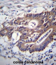 AP52411PU-N - Cytokeratin 12