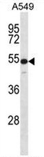 AP52419PU-N - Cytokeratin 7
