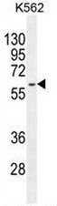 AP52420PU-N - Cytokeratin 73
