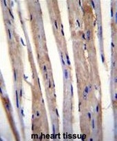 AP52420PU-N - Cytokeratin 73