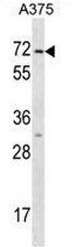 AP52422PU-N - Cytokeratin 75