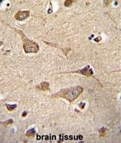 AP52428PU-N - Kinase suppressor of Ras 2