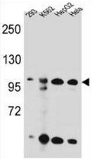 AP52428PU-N - Kinase suppressor of Ras 2