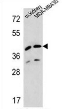 AP52435PU-N - Duranin