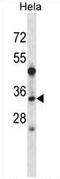 AP52448PU-N - LAT2 / WBSCR15