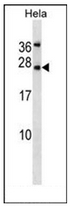 AP52465PU-N - Leptin