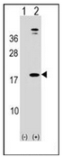 AP52465PU-N - Leptin
