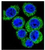 AP52465PU-N - Leptin