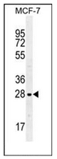 AP52468PU-N - Galectin-3