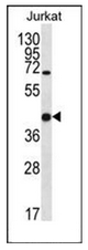 AP52469PU-N - Galectin-4