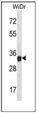 AP52470PU-N - Galectin-9
