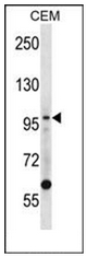 AP52477PU-N - DNA ligase 1