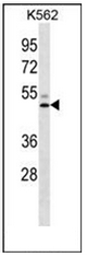 AP52492PU-N - LIPC / Hepatic lipase