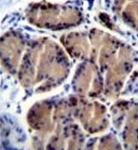 AP52492PU-N - LIPC / Hepatic lipase