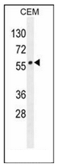 AP52493PU-N - LIPC / Hepatic lipase