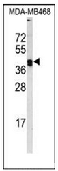 AP52513PU-N - Lysyl oxidase
