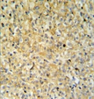 AP52604PU-N - MAPK1IP1L