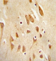 AP52605PU-N - MAPK8 / JNK1
