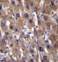 AP52613PU-N - MAT1A