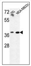 AP52614PU-N - MAT2B
