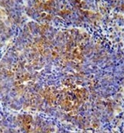 AP52629PU-N - ATF7IP2