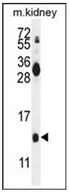 AP52643PU-N - Midkine