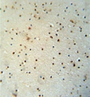 AP52653PU-N - MED25
