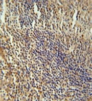AP52661PU-N - MEF2A