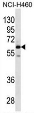 AP52667PU-N - MEPE / OF45