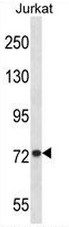 AP52679PU-N - Mitofusin-1