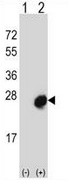 AP52696PU-N - Mid1-interacting protein 1