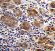 AP52706PU-N - Melanophilin