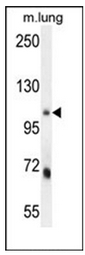 AP52708PU-N - MLX-interacting protein