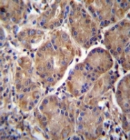 AP52714PU-N - Multimerin-2