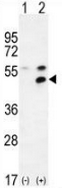 AP52738PU-N - MPP1